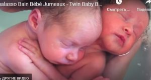 Младенцы-близнецы уже родились, но пока не знают этого  Видео