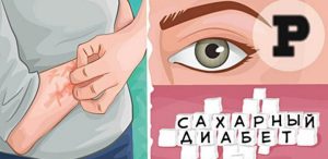 9 симптомов высокого уровня сахара, которые нельзя игнорировать