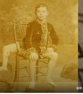 3 ноги и 2 мужских органа! Шокирующая история Фрэнка Лентини  Видео